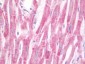 ULK2 Antibody (Internal)